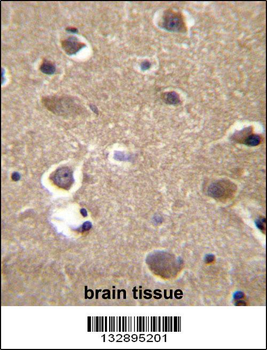 MRPL9 Antibody (N-term)