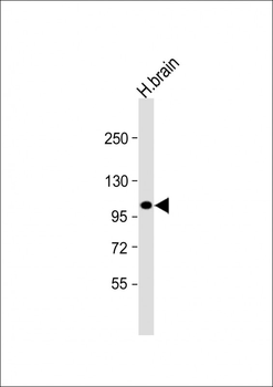 ANKRD6 Antibody (Center)