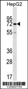 CTPS2 Antibody (C-term)