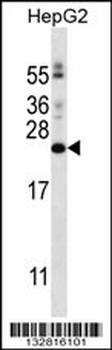 PIGH Antibody (N-term)