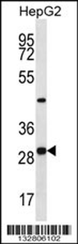 PROSC Antibody (C-term)