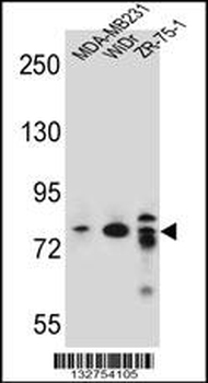ARHGAP22 Antibody (C-term)
