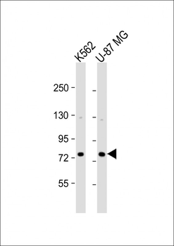ARHGAP22 Antibody (C-term)