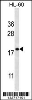 TMM70 Antibody (C-term)