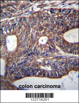 UQCRB Antibody (Center)