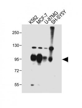 SEMA4C Antibody (C-term)
