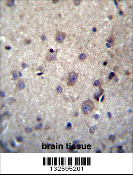 HBQ1 Antibody (N-term)