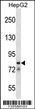 CATSPER1 Antibody (N-term)