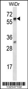 LARP7 Antibody (C-term)