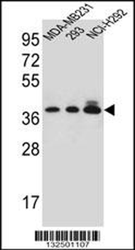 TAS2R1 Antibody (C-term)