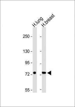 SLC6A14 Antibody (C-term)