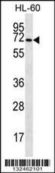 SLC6A14 Antibody (C-term)