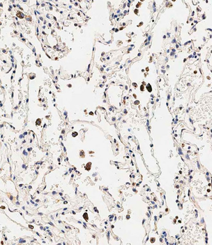 SLC6A14 Antibody (C-term)