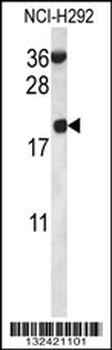 RPS12 Antibody (N-term)