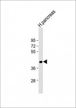 SFRP5 Antibody (Center)