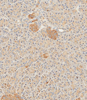 SFRP5 Antibody (Center)