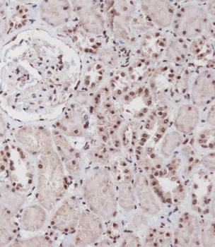 SIM1 Antibody (N-term)