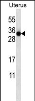 C2orf73 Antibody (N-term)