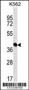 PAICS Antibody (N-term)