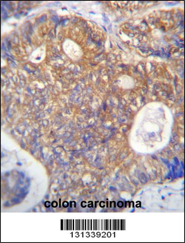 PAICS Antibody (N-term)