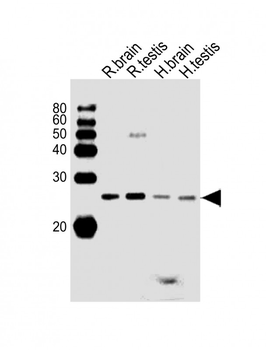 RAB11B Antibody (C-term)