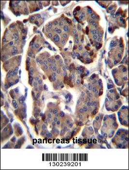 RAB11B Antibody (C-term)