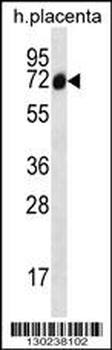 SCLT1 Antibody (C-term)