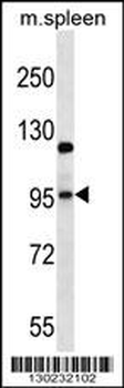 GRIA4 Antibody (Center)