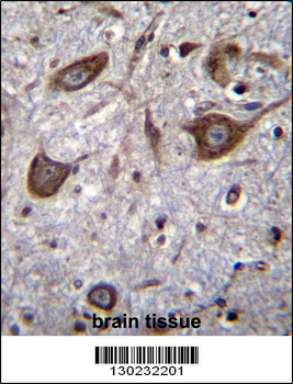 GRIA4 Antibody (Center)