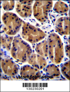 PKP2 Antibody (C-term)