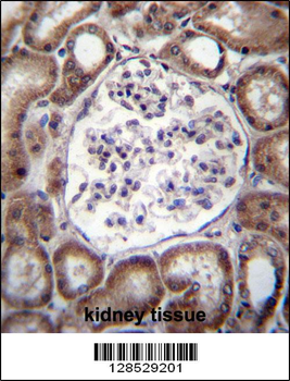 VPS54 Antibody (Center)