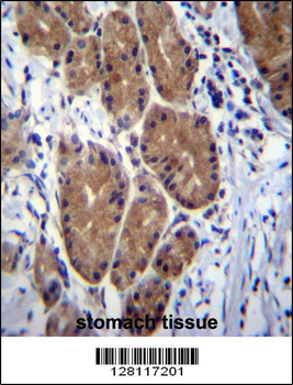 ZCRB1 Antibody (C-term)