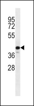 C9orf72 Antibody (C-term)
