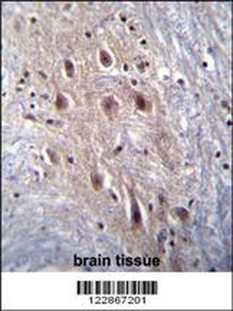 HIPK4 Antibody