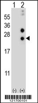CSN1S1 Antibody (Center)