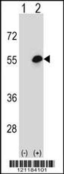 COCH Antibody (Center)