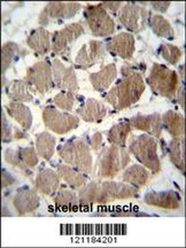COCH Antibody (Center)