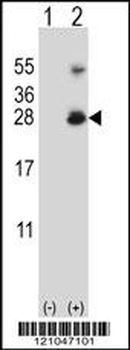 RNF11 Antibody (Center)