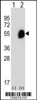 GCDH Antibody (C-term)