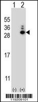 MOBKL1B Antibody (N-term)