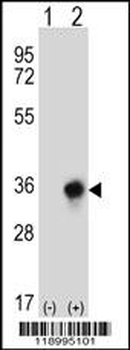 CBR3 Antibody (C-term)