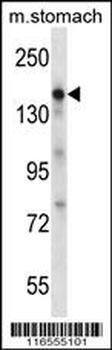 EGF Antibody (Center)