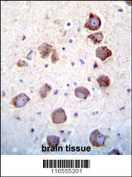 EGF Antibody (Center)