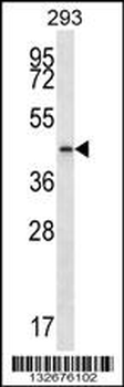 PTGR2 Antibody (N-term)