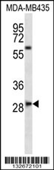 SLAMF8 Antibody (C-term)