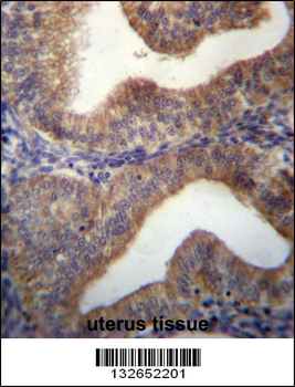 SLC29A3 Antibody (N-term)