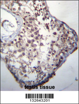 GLCCI1 Antibody (Center)