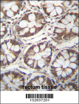 LAD1 Antibody (N-term)