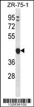 YIPF1 Antibody (N-term)