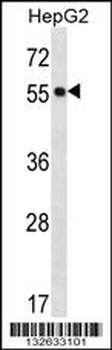 POFUT2 Antibody (Center)